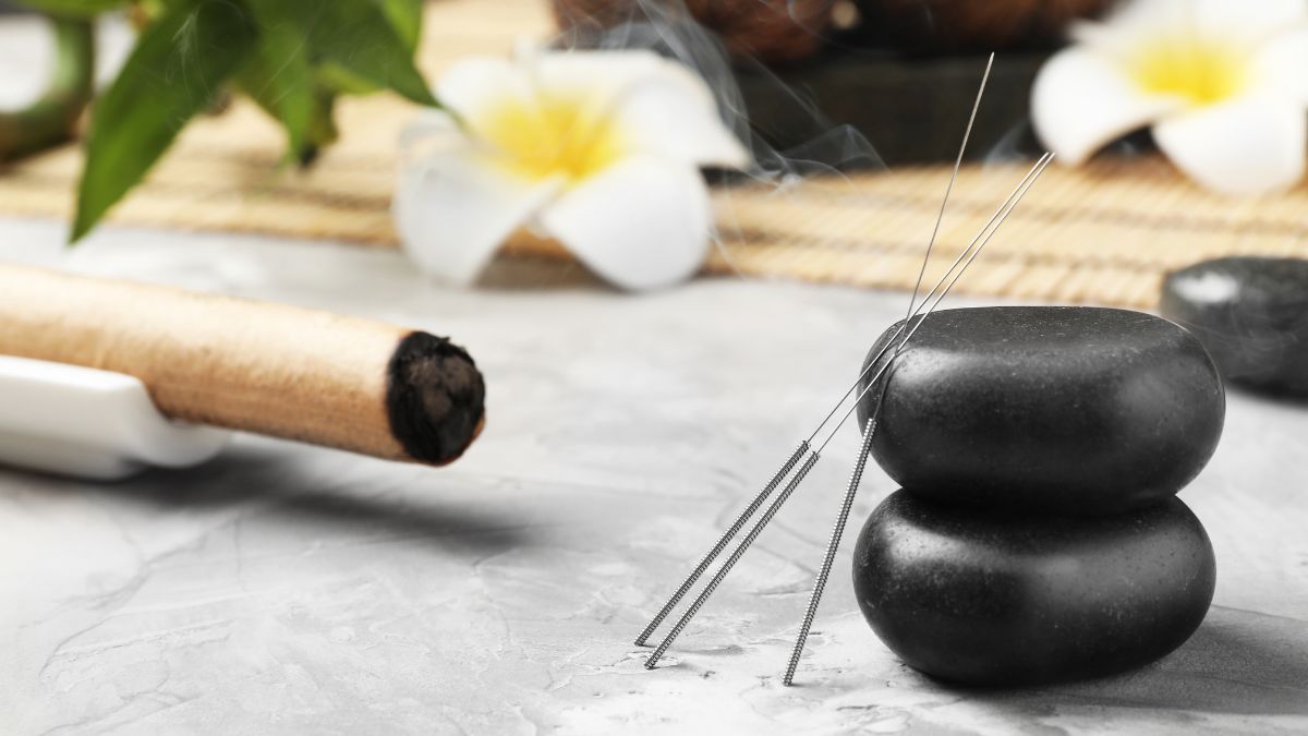 A photo of an acupuncture needle, a stone, and other materials for transformational healing