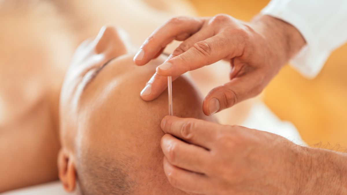 A man receiving acupuncture treatment